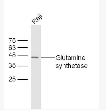 Anti-Glutamine synthetase antibody -谷氨酰胺合成酶/谷氨酸氨连接酶抗体
