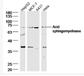 Anti-Acid sphingomyelinase antibody -酸性神经鞘磷脂酶抗体