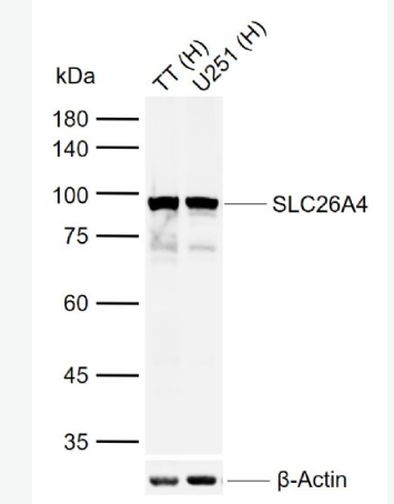 Anti-SLC26A4 antibody -钠碘单独转运蛋白SLC26A4抗体