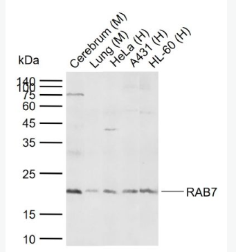 Anti-RAB7A antibody -RAS癌基因相关蛋白RAB7抗体