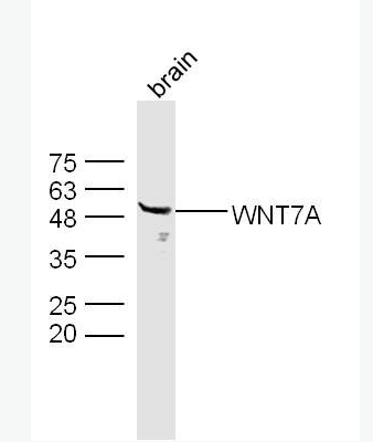 Anti-WNT7A antibody -原癌基因wnt7a蛋白抗体