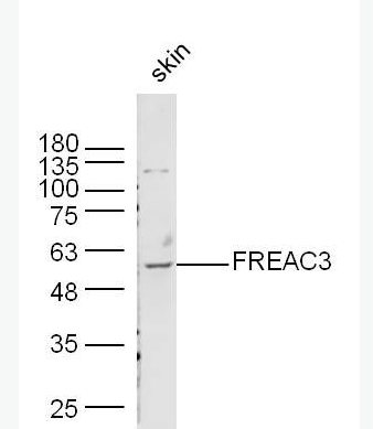 Anti-FREAC3 antibody -叉头相关转录因子3/FOXC1抗体