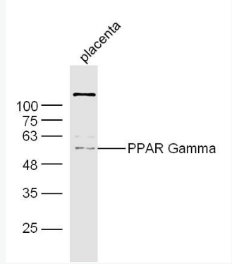 Anti-PPAR Gamma antibody -过氧化酶活化增生受体γ抗体