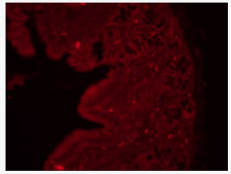 Anti-MLCK antibody -肌球蛋白轻链激酶抗体