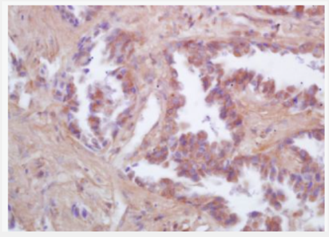 Anti-FIS1 antibody -线粒体裂变1蛋白抗体