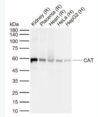 Anti-CAT antibody -过氧化氢酶抗体