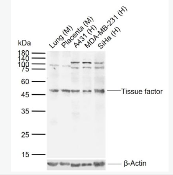 Anti-Tissue factor antibody -组织因子（CD142）抗体