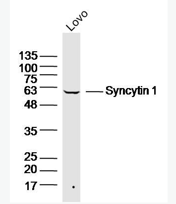 Anti-Syncytin 1 antibody -合胞素1抗体