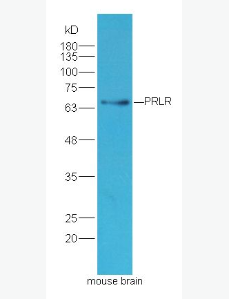 Anti-PRLR antibody -泌乳素受体抗体