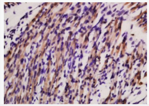 Anti-Sarcomeric Alpha Actinin antibody -α横纹肌辅肌动蛋白/α-SCA抗体