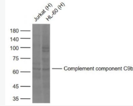 Anti-Complement component C9b antibody -补体C9b抗体