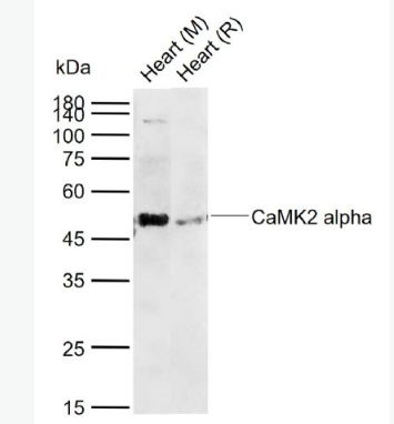 Anti-CaMK2 alpha antibody -钙/钙调素依赖蛋白激酶2α抗体