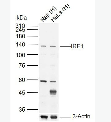 Anti-IRE1 antibody -内质网核信号转导蛋白a1抗体