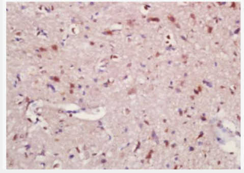 Anti-OLIG2 antibody -少突胶质细胞转录因子2抗体