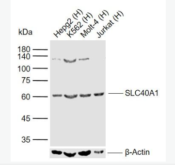 Anti-SLC40A1 antibody -细胞膜铁转运蛋白FP1抗体