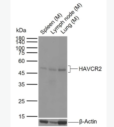 Anti-HAVCR2/TIM-3 antibody -T淋巴细胞膜蛋白3(CD366)抗体