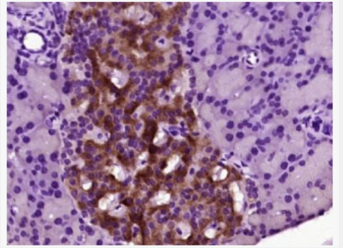 Anti-Ghrelin antibody -脑肠肽抗体