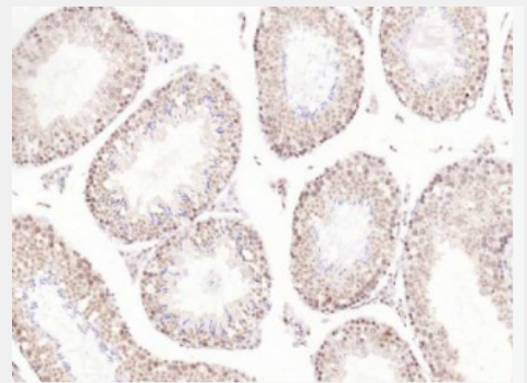 Anti-FEstrogen receptor beta antibody -雌激素受体β抗体