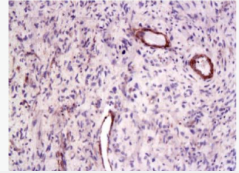 Anti-CTGF antibody -结缔组织生长因子抗体