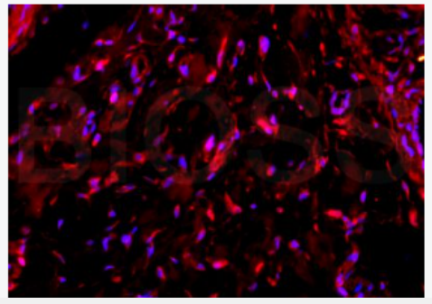 Anti-COL5A1 antibody -Ⅴ型胶原抗体