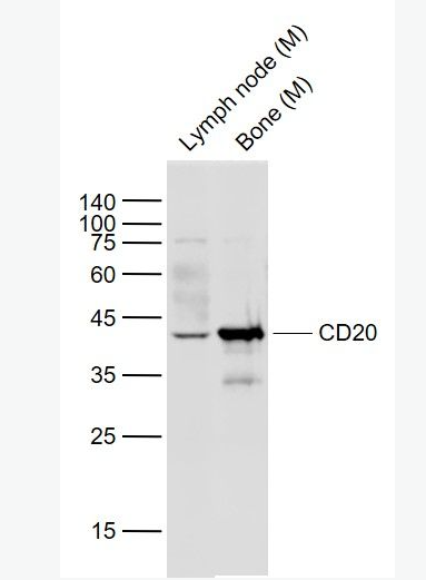 Anti-CD20 antibody -CD20抗体