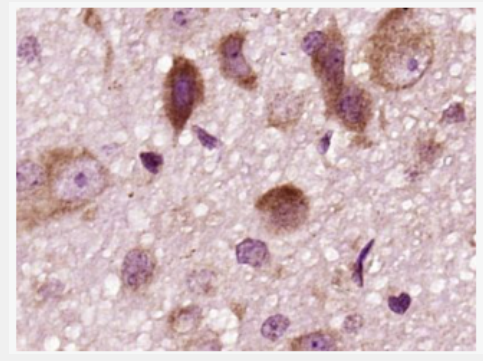 Anti-DRD2 antibody -多巴胺受体D2抗体