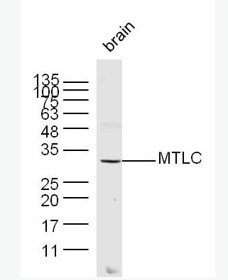 Anti-MTLC antibody -致癌基因抗体