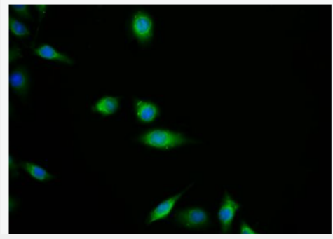 Anti-ERBB2/HER2 antibody -ERBB2/HER2抗体