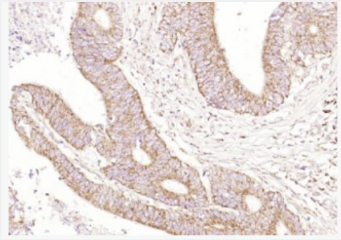 Anti-CEAcam8 antibody -癌胚抗原相关细胞粘附分子8抗体