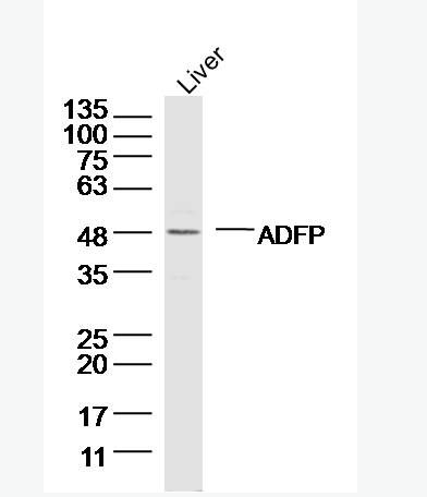 Anti-Perilipin-2 antibody -脂肪分化相关蛋白抗体