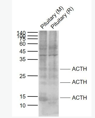 Anti-ACTH (7-23) antibody -促肾上腺皮质激素ACTH (7-23)抗体