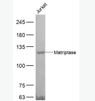 Anti-Matriptase antibody-蛋白裂解酶（一种新的癌基因）抗体