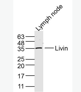 Anti-Livin antibody-凋亡抑制蛋白抗体