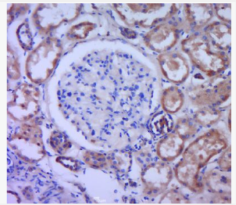 Anti-GNRH/LHRH antibody-黄体激素释放激素类似物抗体