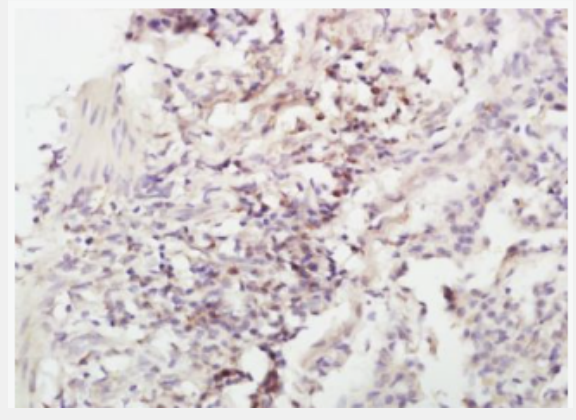 Anti-IL-4 antibody-白介素4抗体