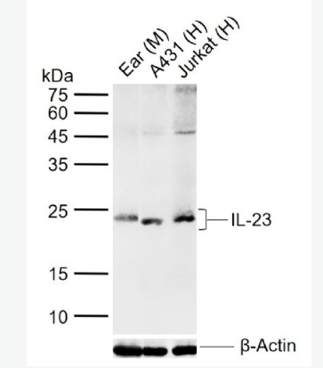 Anti-IL-23 antibody-白介素-23抗体