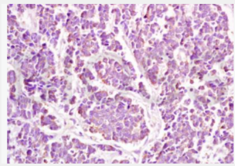 Anti-HLA G antibody-人类白细胞抗原G抗体