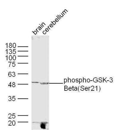 Anti-phospho-GSK-3 Beta (Ser21) antibody-磷酸化糖原合酶激酶3β抗体