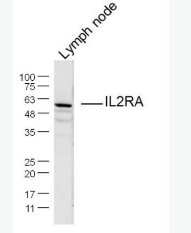 Anti-IL2RA/CD25 antibody-白介素2受体a链/IL-2RA抗体