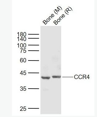 Anti-CCR4 antibody-细胞表面趋化因子受体4抗体