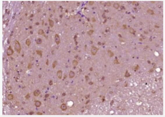 Anti-CCK8 antibody-胆囊收缩素8抗体