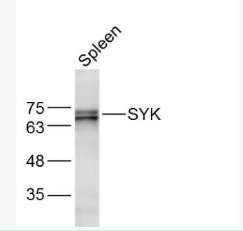 Anti-SYK antibody非受体型酪氨酸蛋白激酶抗体