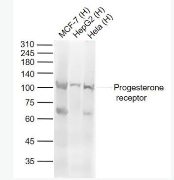 Anti-progesterone receptorantibody-孕激素受体抗体