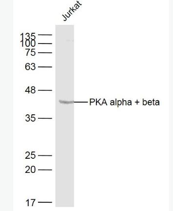 Anti-PKA alpha + beta antibody-蛋白激酶A抗体
