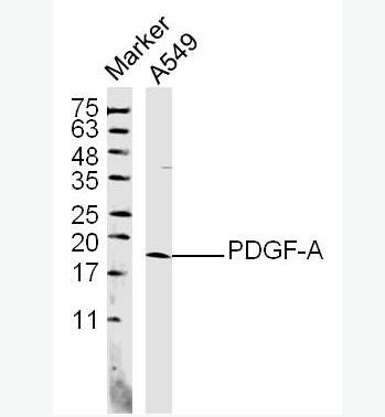 Anti-PDGF-A antibody-血小板源性生长因子A抗体