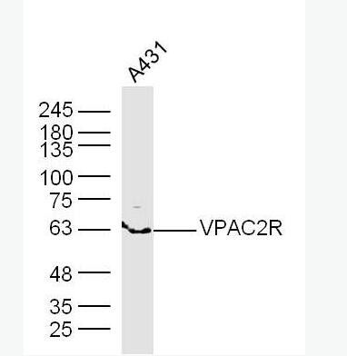 Anti-VPAC2R antibody-腺苷酸环化酶激活肽受体-II/血管活性肠肽受体-II抗体