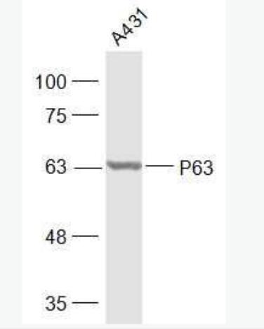 Anti-P63 antibody-肿瘤抑制基因p63α抗体