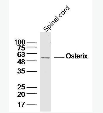 Anti-SP7/Osterix  antibody-成骨相关转录因子抗体