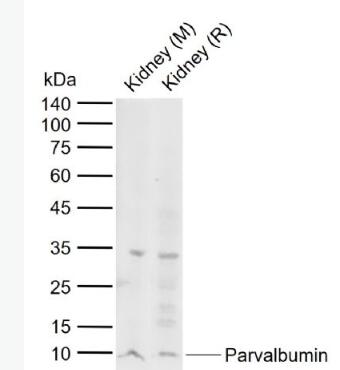 Anti-Parvalbumin antibody-细小清蛋白抗体