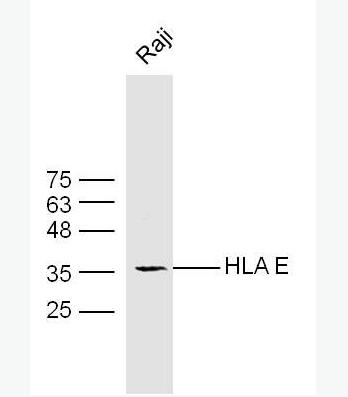 Anti-HLA E antibody-人类白细胞抗原E抗体